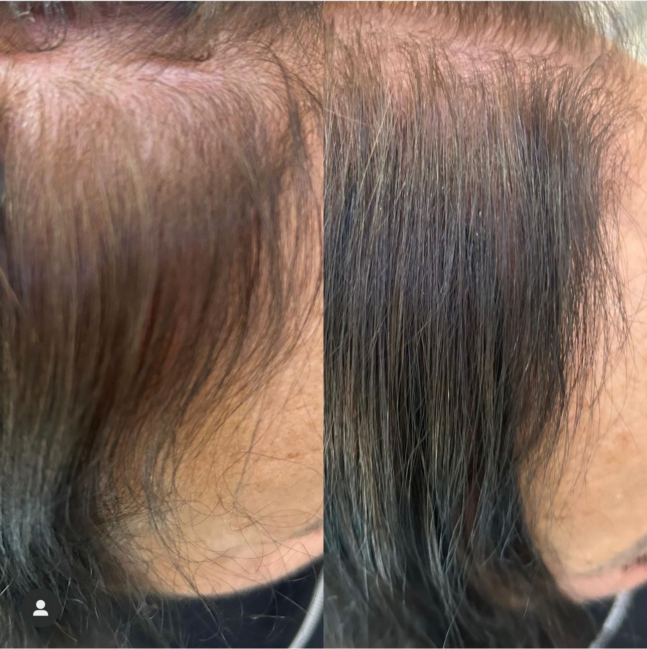 Introducing V-light Hair Extensions