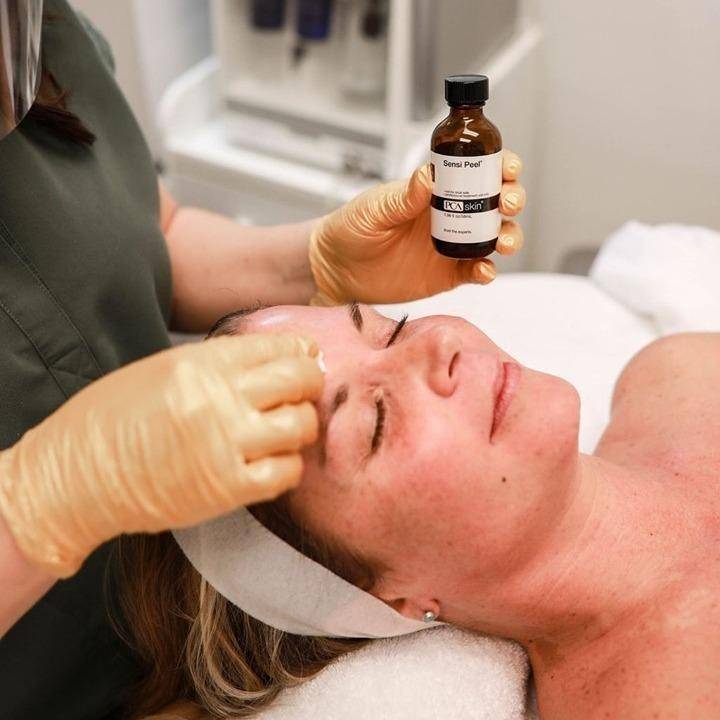 Professional Skin Peel Treatment near me Image London beauty salons